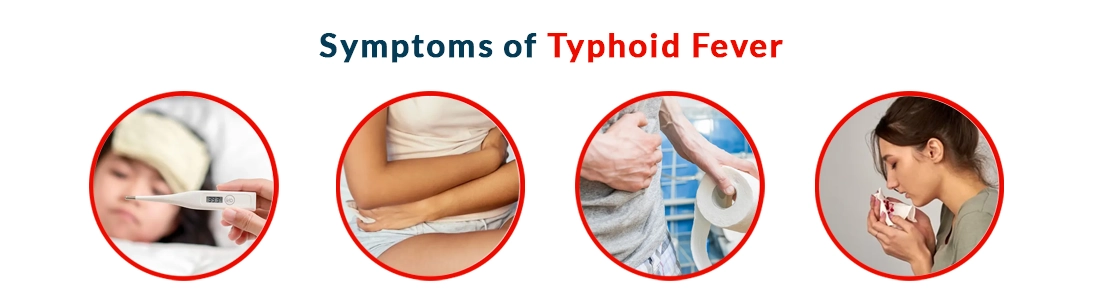 Symptoms of Typhoid Fever